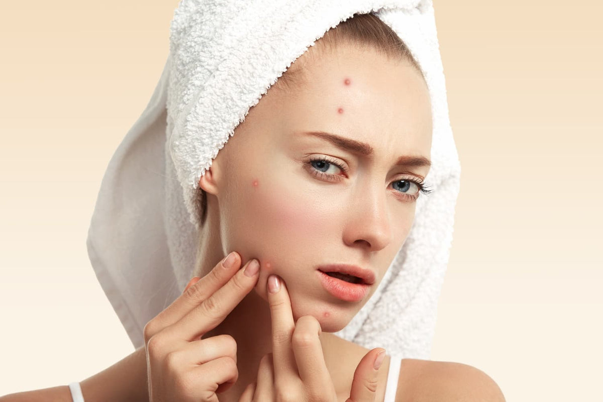 Makyaj Yaptığımda Neden Sivilce Çıkıyor — Alix Avien blog görseli